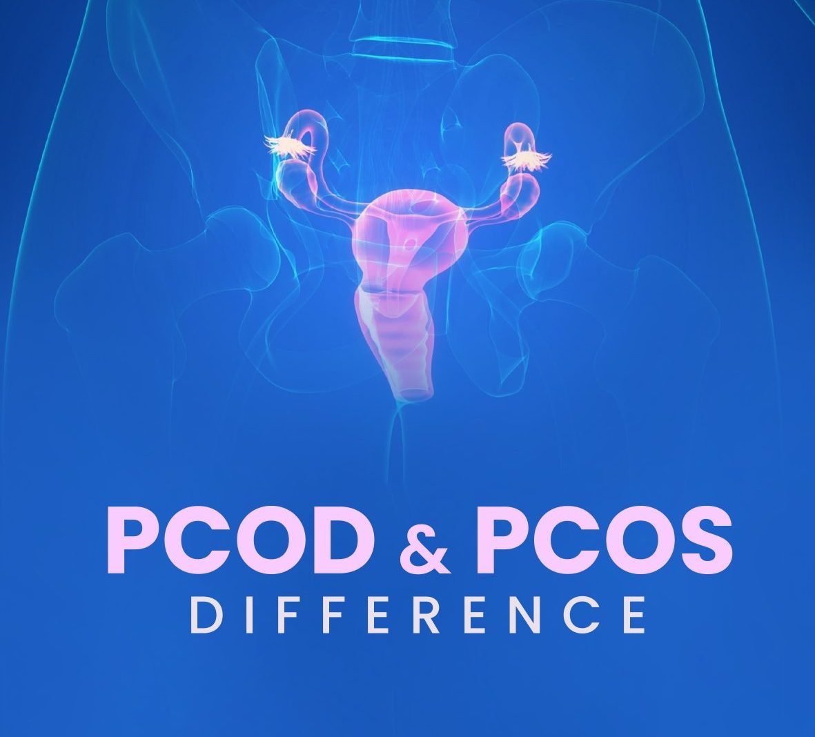 "PCOD", "PCOS"