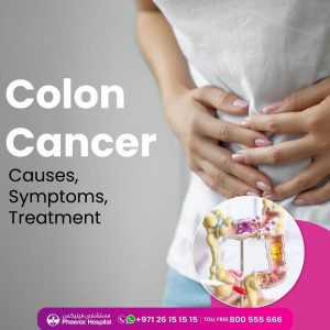 "colon cancer"