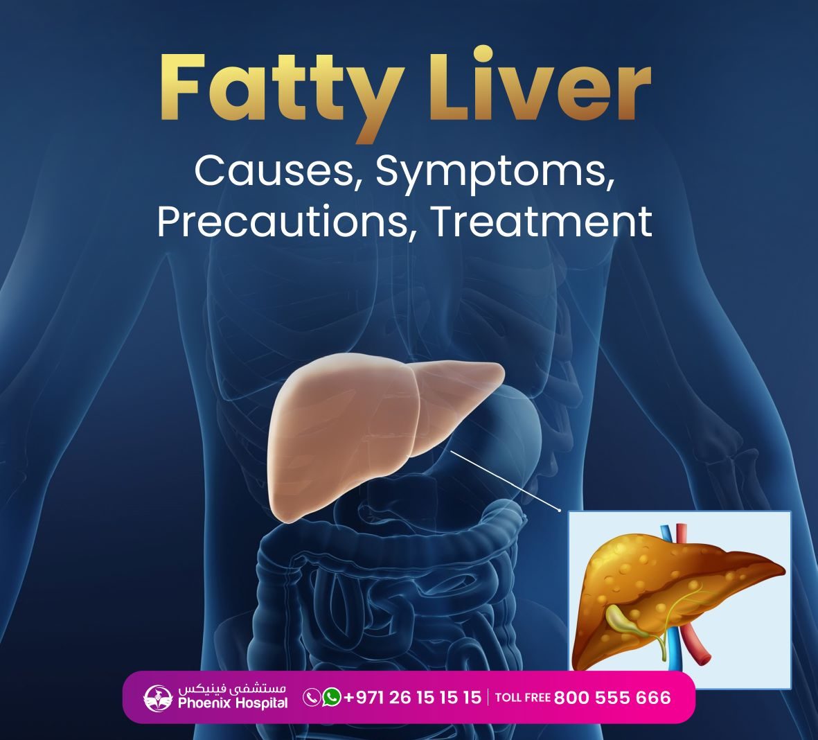 "fatty liver", "liver cirrhosis"