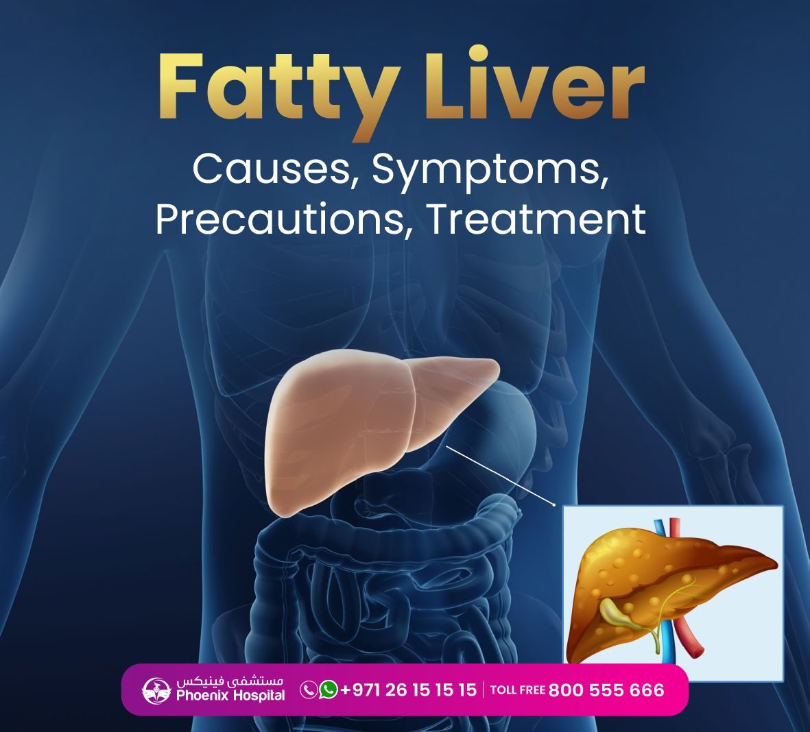 Fatty Liver Symptoms Causes And Digestion Phoenix Hospital